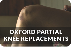 Oxford Partial Knee Replacements