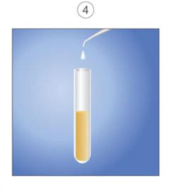 A graphic illustrating the fourth step in the PRP Therapy process. It shows a vial of platelet-rich plasma.