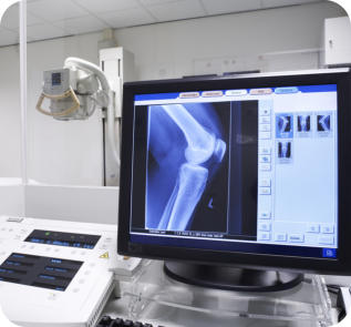 Photo of knee x-rays being displayed on a computer screen with medical equipment behind it.