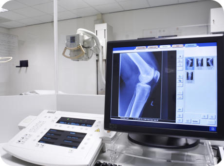 Photo of knee x-rays being displayed on a computer screen with medical equipment behind it.
